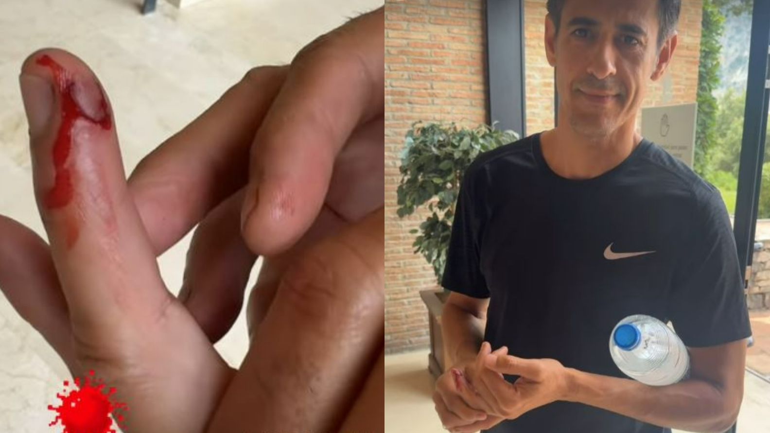 El accidente que ha sufrido Víctor Janeiro