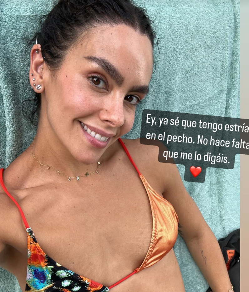 Cristina Pedroche enseña las estrías de su pecho