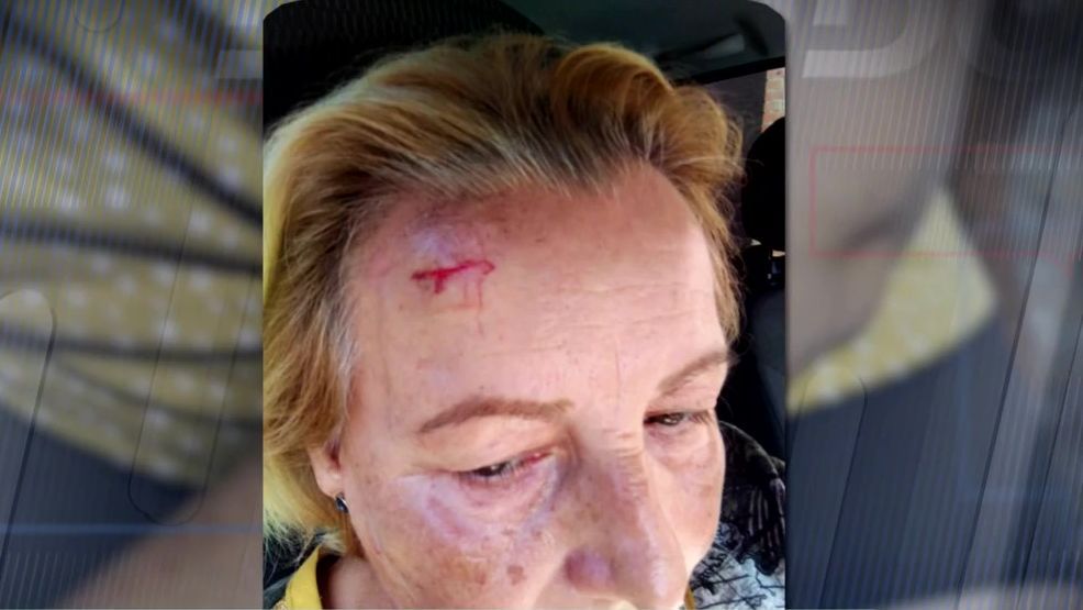 La agresión de María en la frente