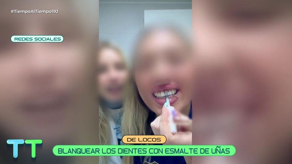 De locos: la nueva moda para blanquearse los dientes utilizando esmalte de uñas