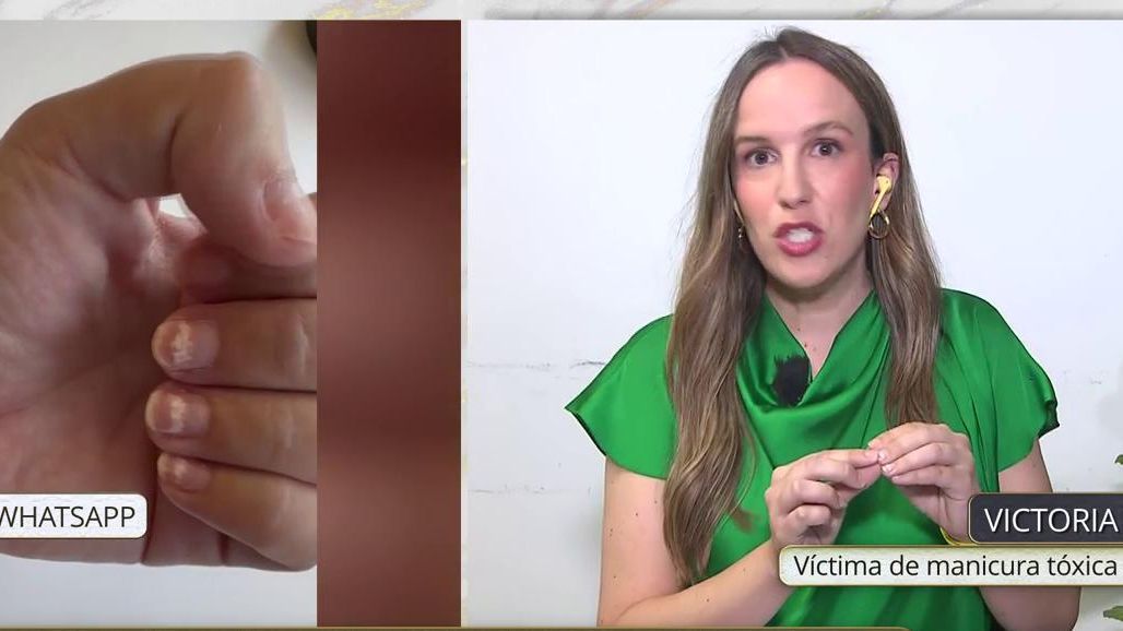 Hablamos con una afectada por el uso de estos peligrosos pintauñas