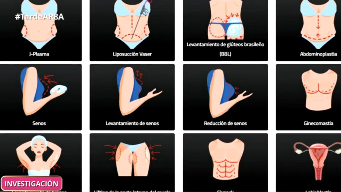 Las distintas operaciones