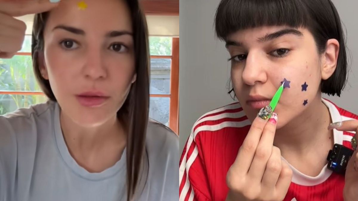 Alexandra Pereira y la influencer Yai Hidalgo usando los parches para los granos