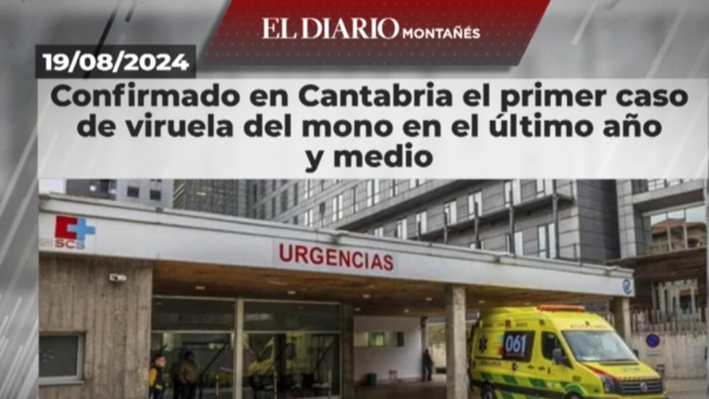 Cantabra registra el primer caso de viruala del mono