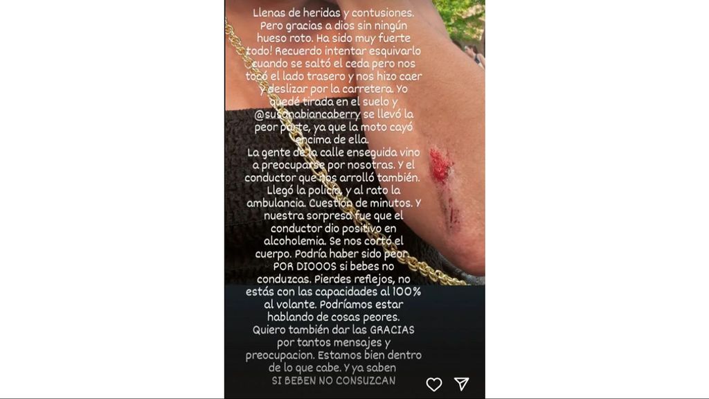 Amor Romeira enseña una de las heridas que tiene en el brazo tras ser atropellada en la moto con Susana Bianca