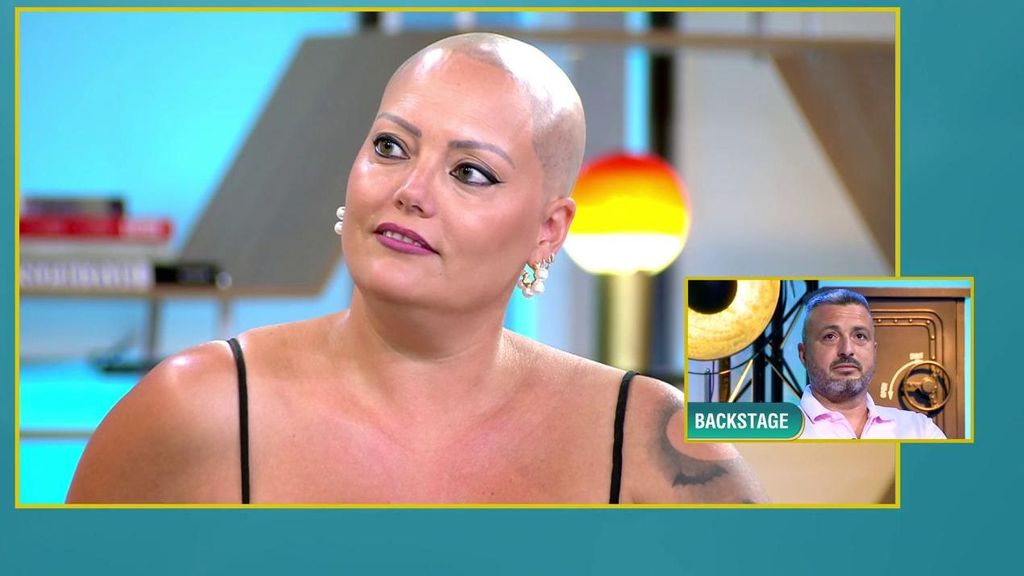 A Ana le cambió la vida cuando empezó a sufrir alopecia: "Fueron años muy duros"