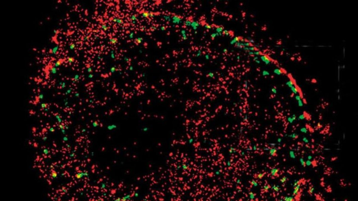 Imágenes STORM solo pueden tomarse con equipos especializadosven laboratorios de investigación biomédica.