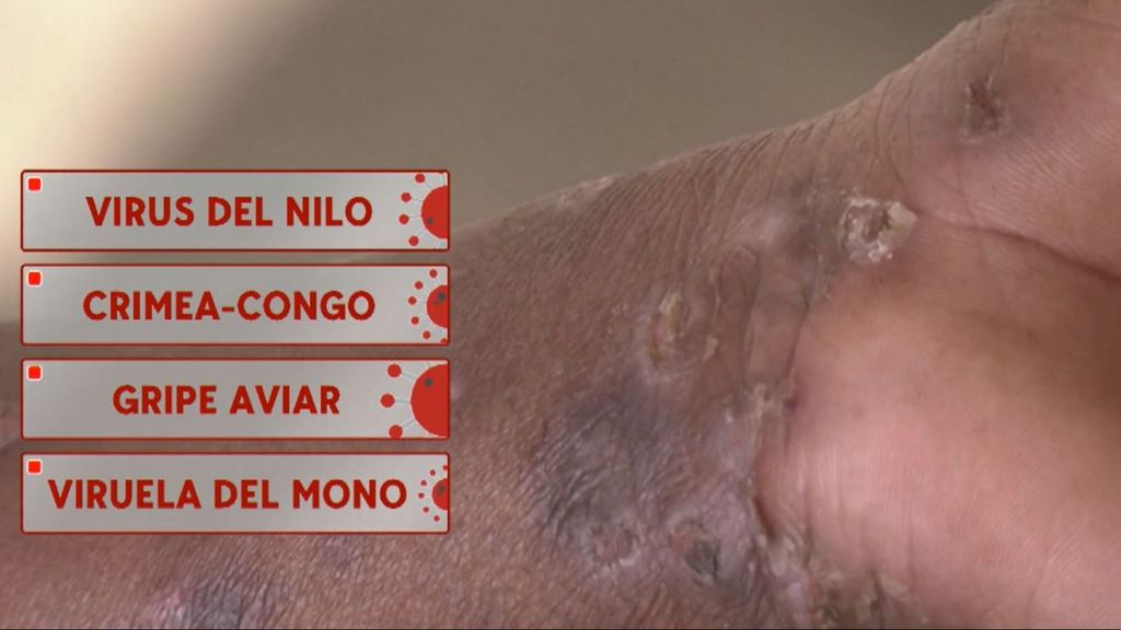 El verano de la zoonosis: ¿por qué aumentan los casos del virus del nilo y la viruela del mono en España?