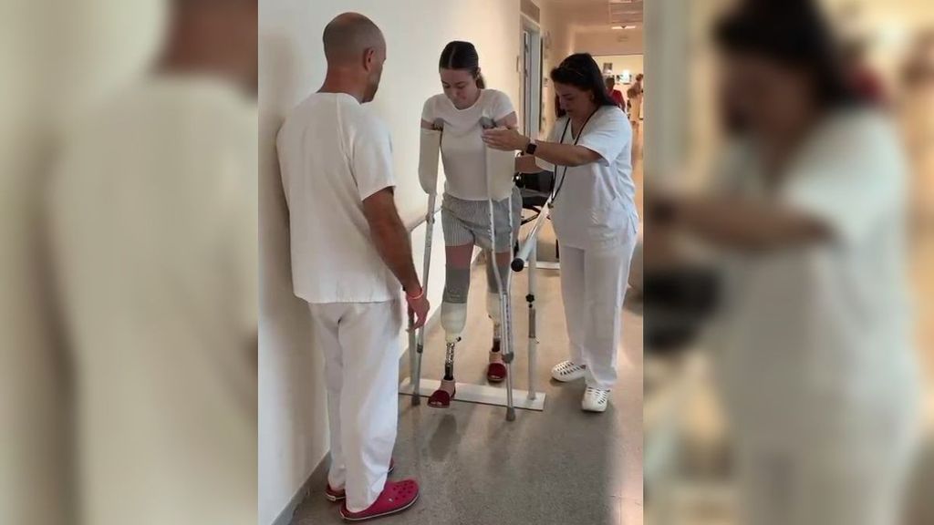 Carla, la joven que perdió las manos y los pies por una bacteria, estrena sus primeras prótesis