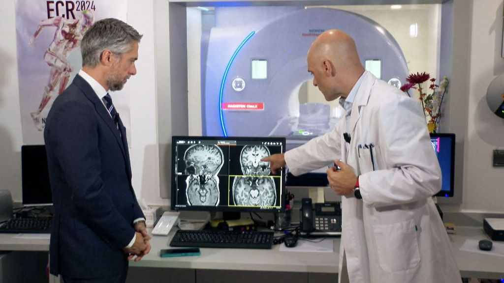 El doctor Pascual Sánchez Juan, desde el Centro Alzheimer Fundación Reina Sofía: "Es el momento de mayor esperanza"