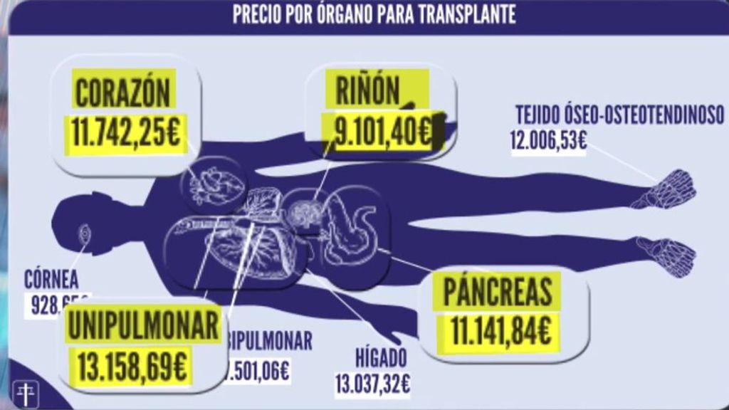 Precios de los órganos trasplantados