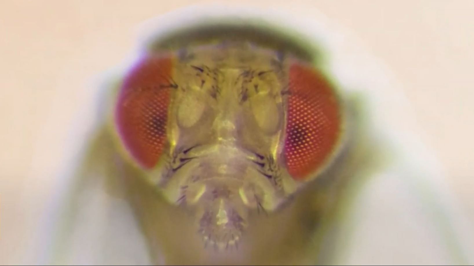 Fruit fly brain map against neurodegenerative diseases