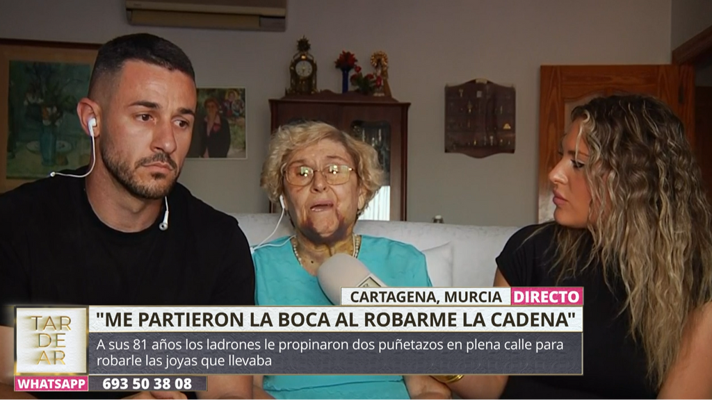 Le parten la mandíbula a puñetazos para robarle una cadena de oro, a sus 81 años: “Fue una cosa espantosa”