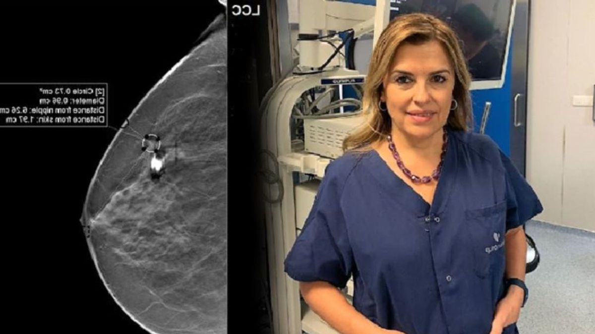 La ginecóloga Carmen Pingarrón detalla las claves para la detección precoz del cáncer de mama: "La autoexploración mamaria no es suficiente"