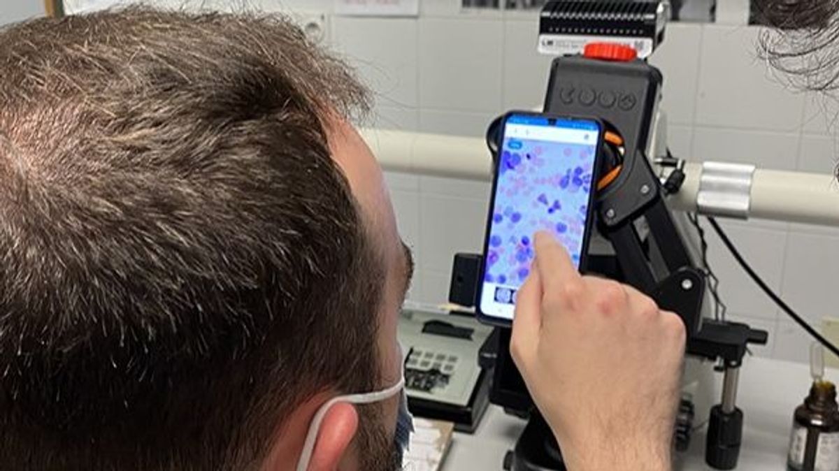 Toma de imágenes de una muestra de médula ósea con un teléfono móvil