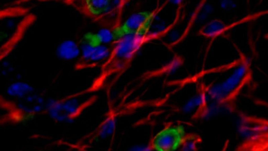 Imagen de células madre humanas trasplantadas en un modelo de ratón con Parkinson.