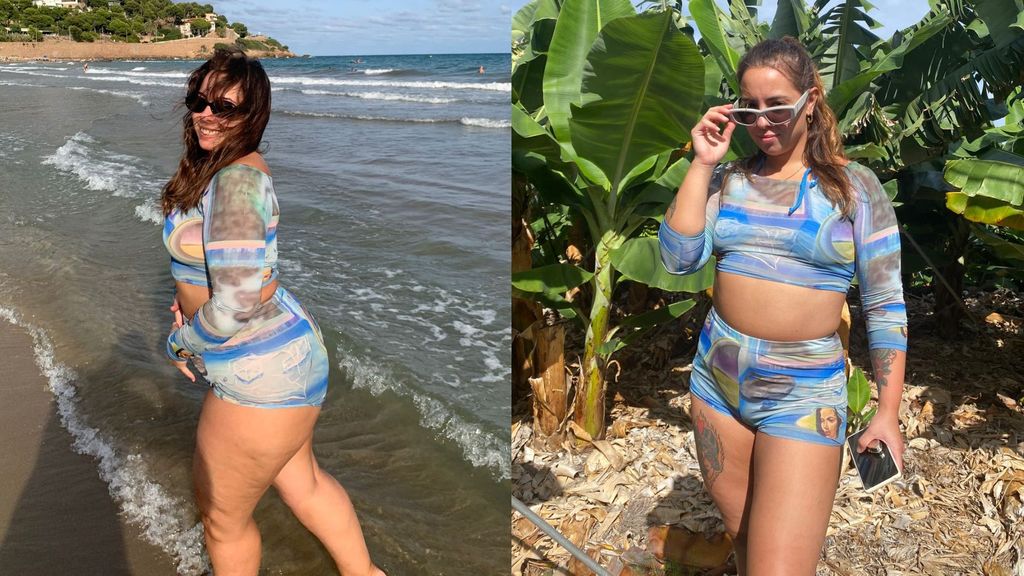 Ana Ayuso, antes y después de operarse de lipedema