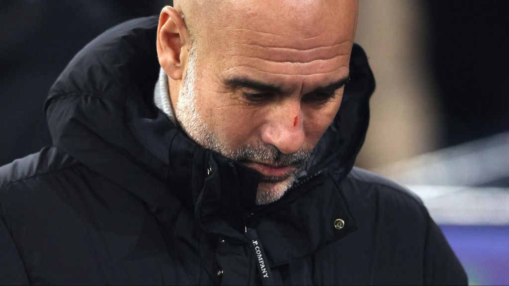 ¿Qué le ha pasado a Pep Guardiola?: aparece con la cabeza llena de arañazos e ironiza con que quiere “hacerse daño”