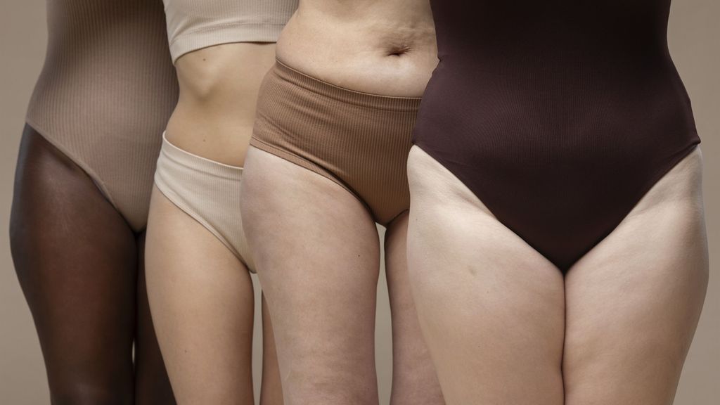 Mujeres con Lipedema