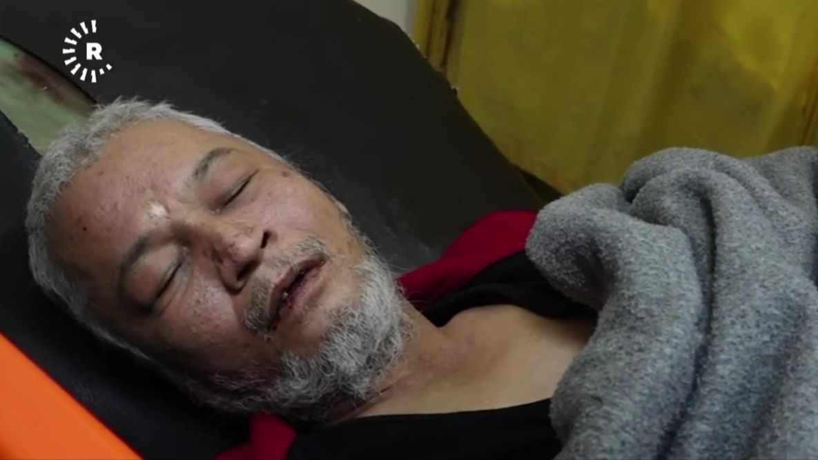 El horror de las cárceles sirias en el rostro de Mohamed, un preso torturado durante más de 40 años