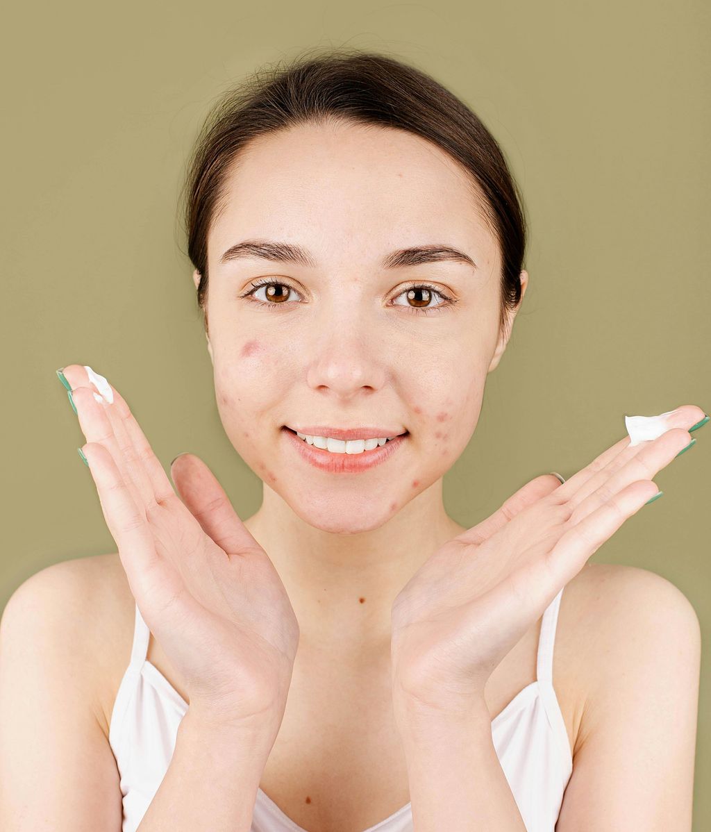 Joven con acné haciendo su rutina facial