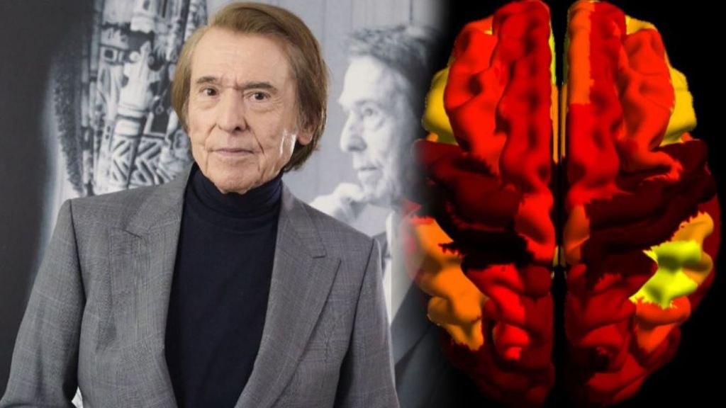 Qué es un linfoma cerebral, la enfermedad que padece Raphael: síntomas y las causas que lo producen