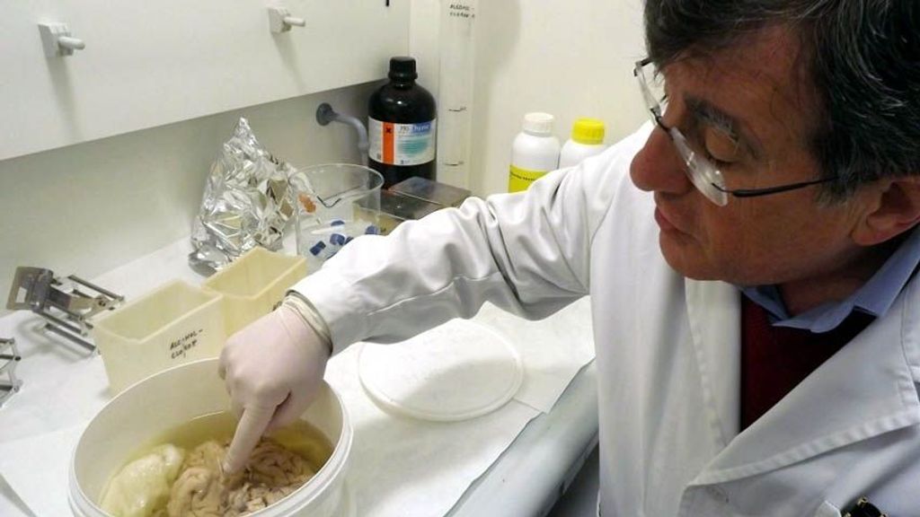 Ricardo Insausti con un cerebro en el laboratorio.