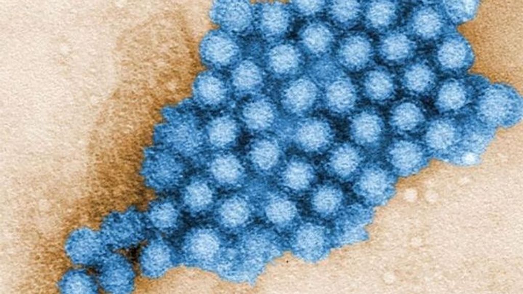 Vista de norovirus es una muestra estomacal