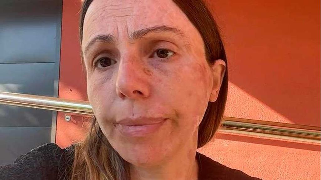 La desesperación de una mujer víctima del accidente del tren de Bejís: "Fue un cúmulo de negligencias brutal"