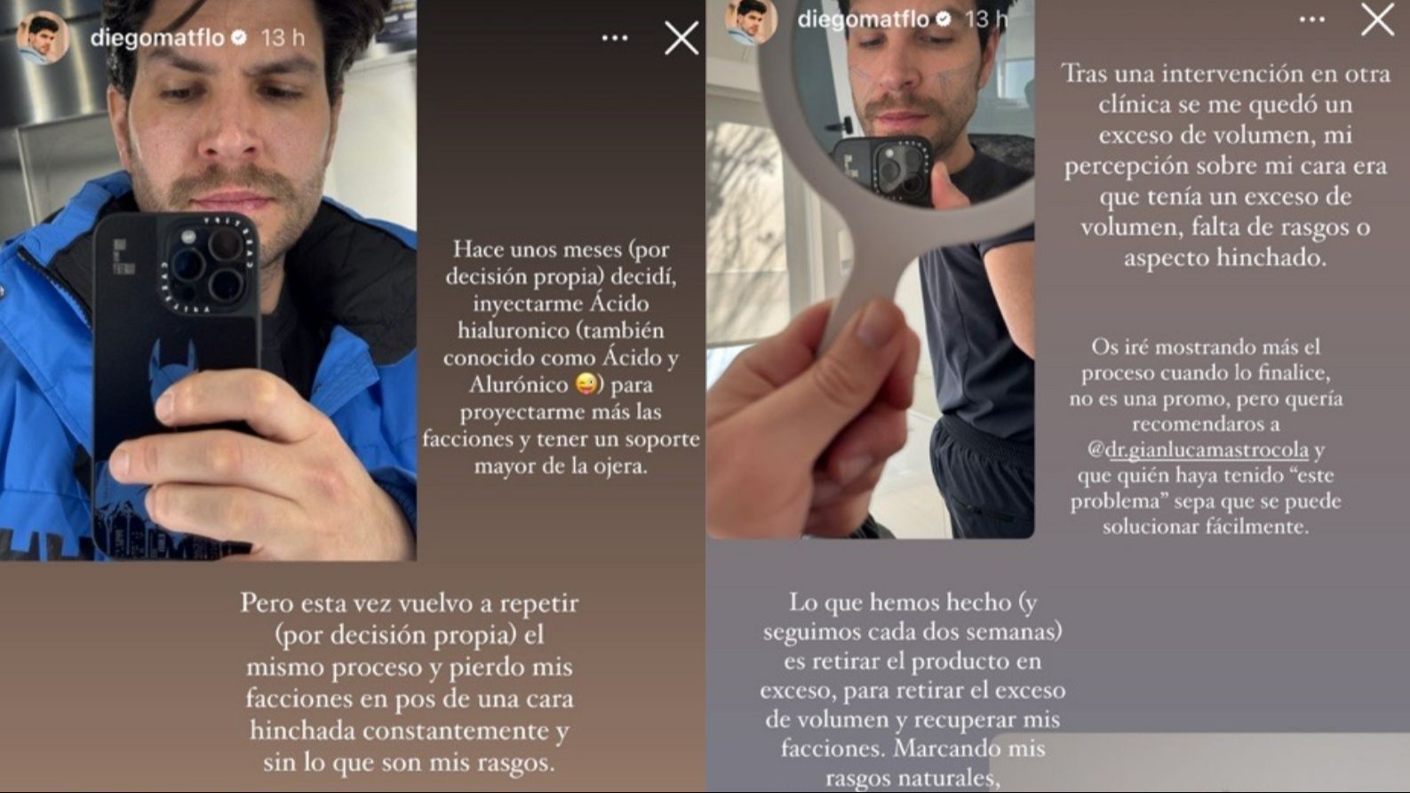 Diego Matamoros explica en qué consiste el proceso al que se está sometiendo