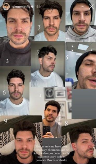 La "reversión" de Diego Matamoros para recuperar su cara