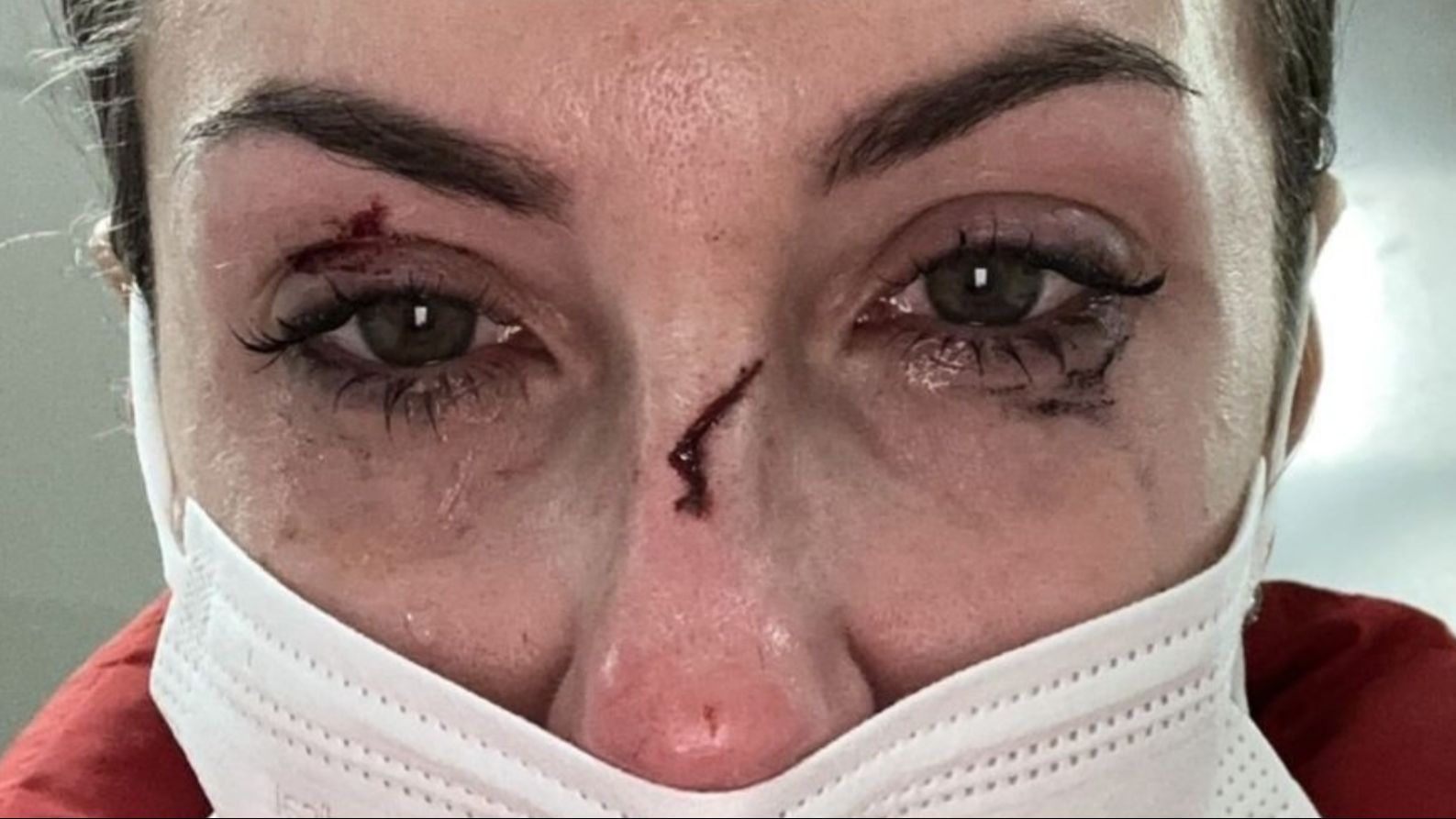 La streamer Gonsabellla muestra las heridas que le ha hecho su gato