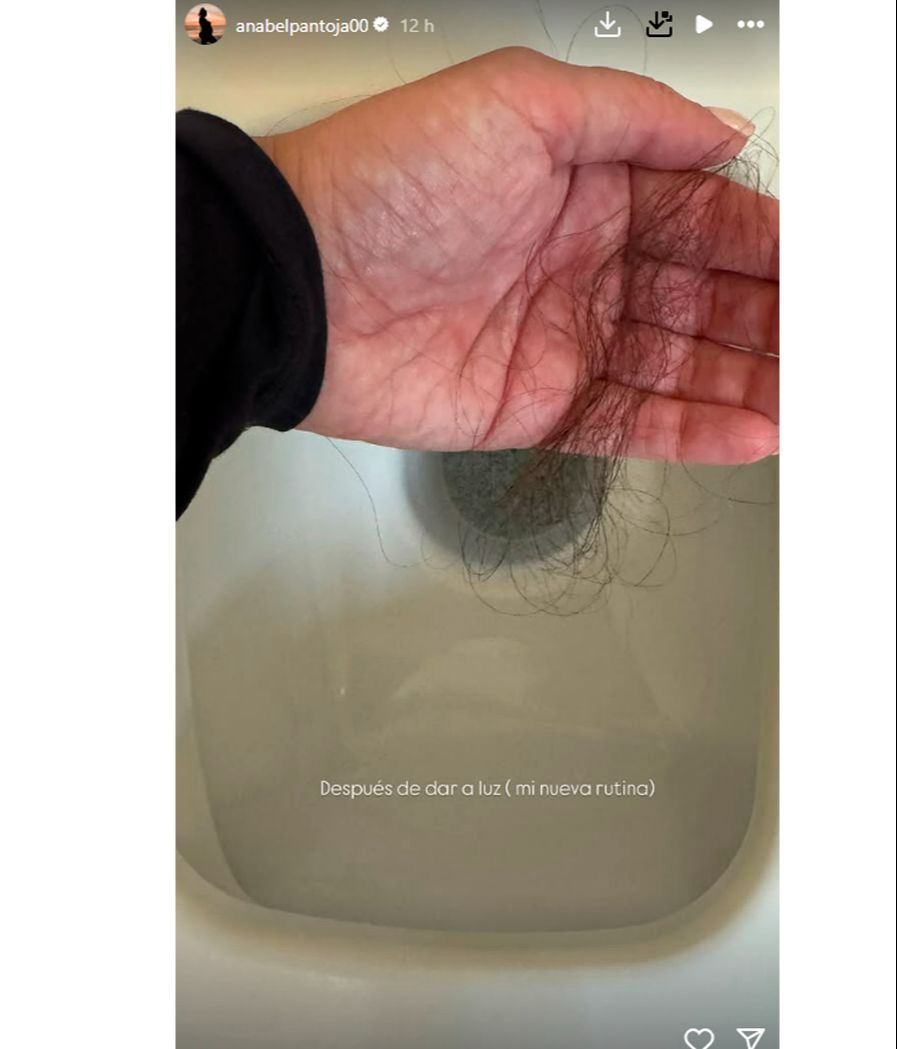 Anabel Pantoja enseña su alarmante caída de pelo tras dar a luz