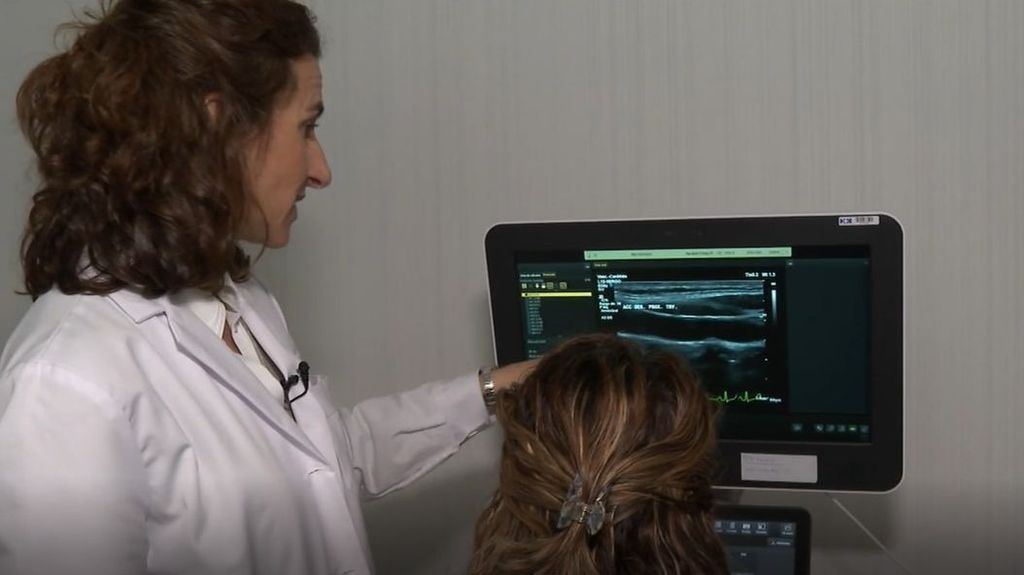El estudio Wake Up, un paso más para prevenir el ictus: se necesitan 720 voluntarias