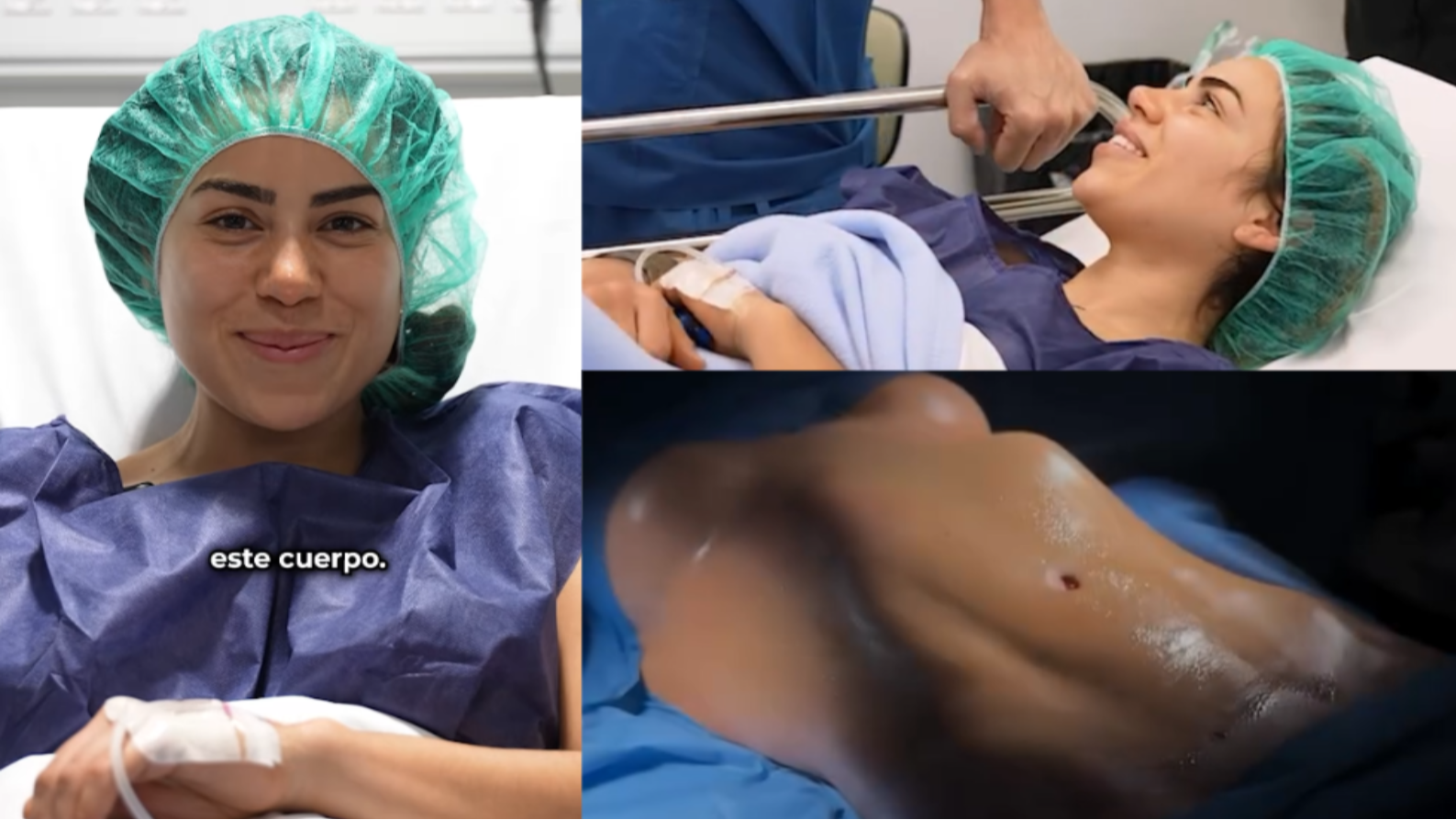 Nataly, tentadora de Joel en ‘La isla de las tentaciones’, desata las críticas tras "arriesgar su vida" con una cirugía estética