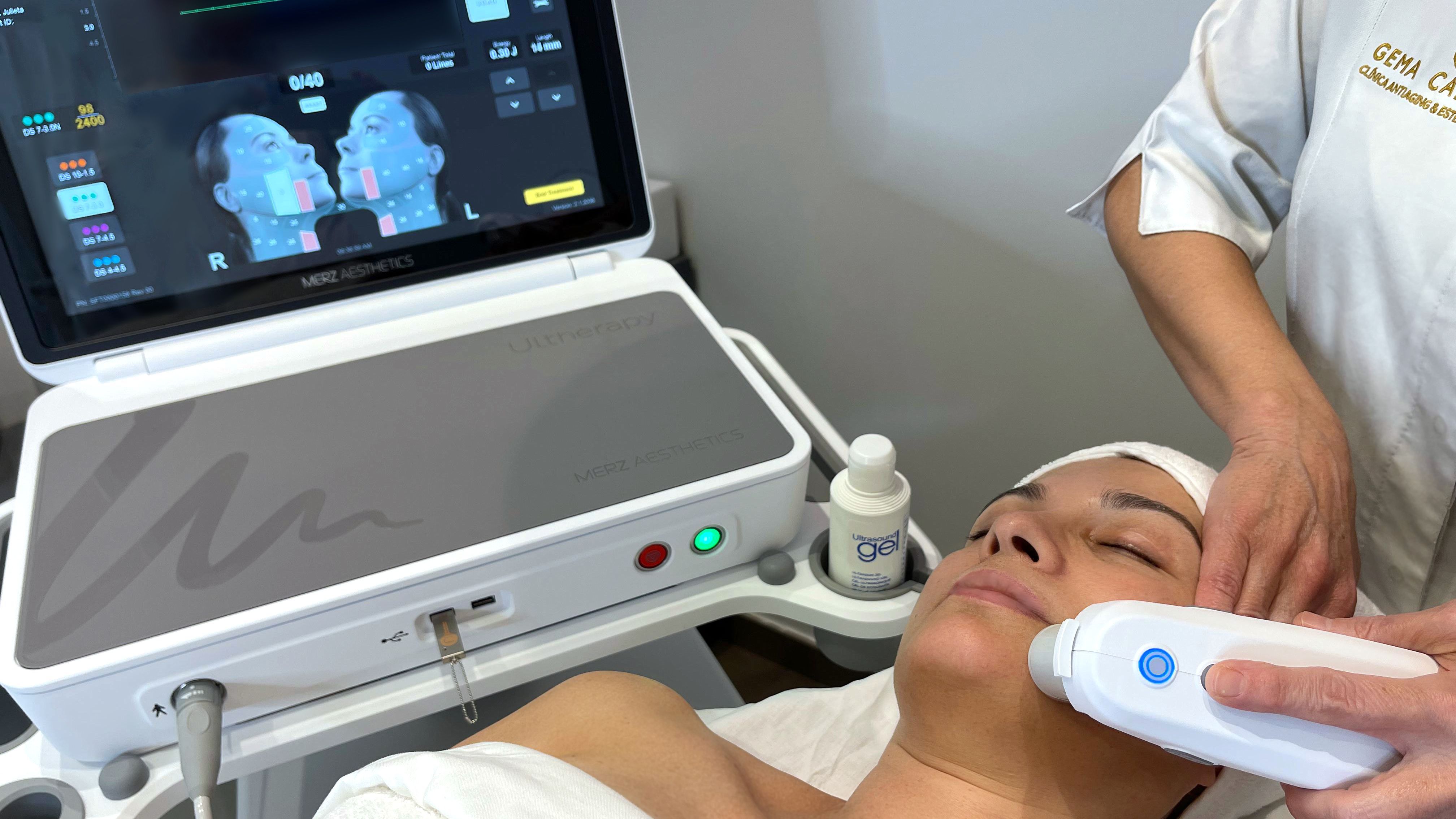 Sesión de Ultherapy Prime