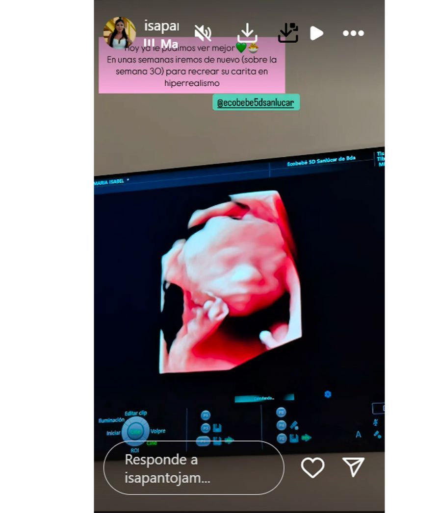 Así han visto Isa Pantoja y Asraf Beno a su hijo en una ecografía 5D