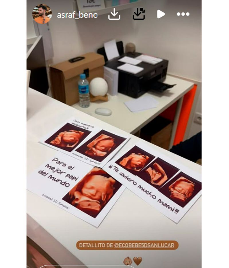 Asraf Beno muestra la carita y el detalle del bebé que esperan