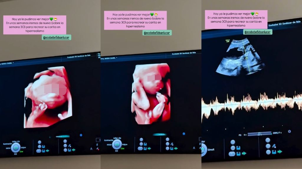 Las imágenes de la ecografía del segundo hijo de Isa Pantoja