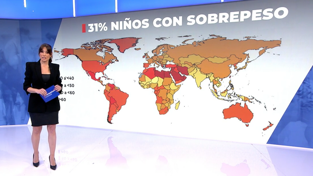 Obesidad infantil