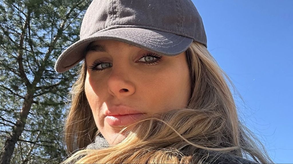 Ivana Icardi enseña sus nuevos retoques estéticos