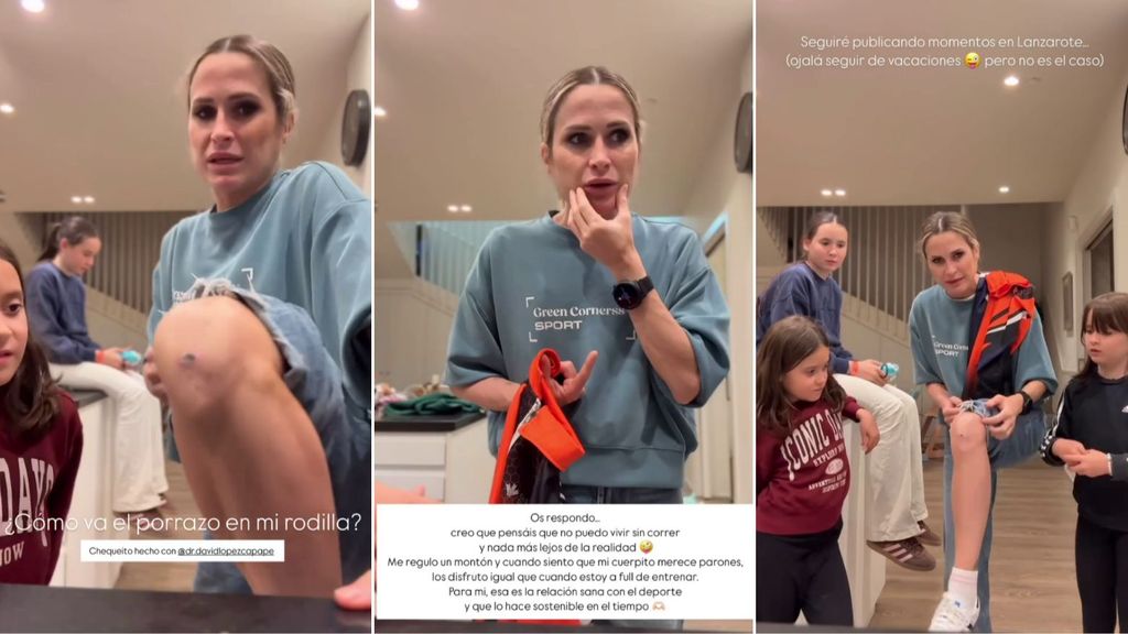 Verdeliss muestra el estado de su rodilla tras guardar reposo