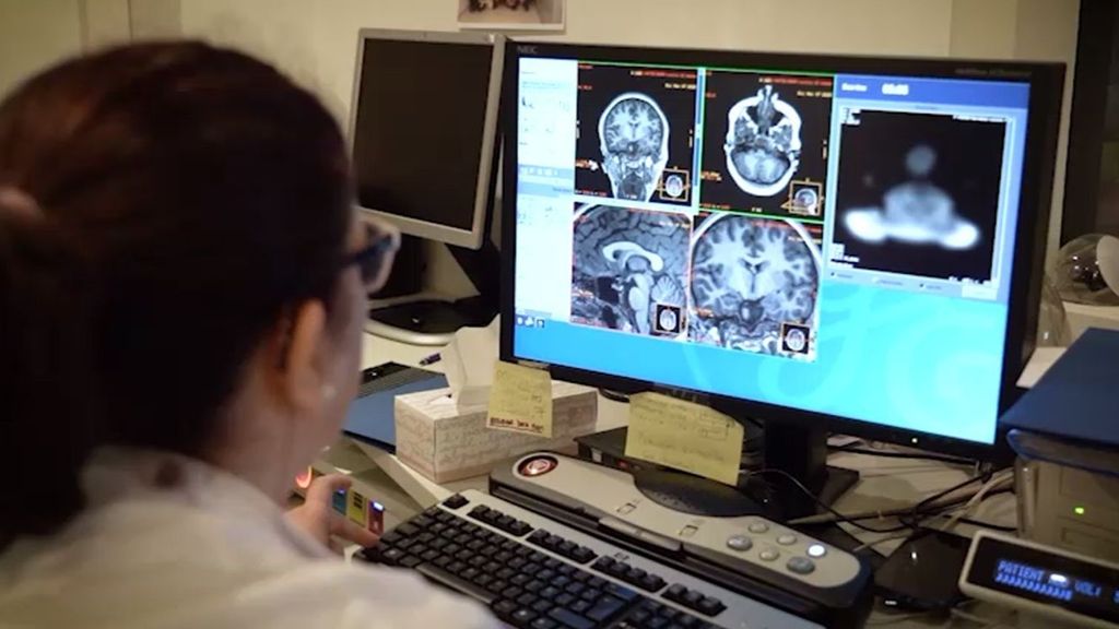 Investigadores creen que hay una conexión entre nuestra forma de respirar y enfermedades neurodegenerativas como el alzhéimer