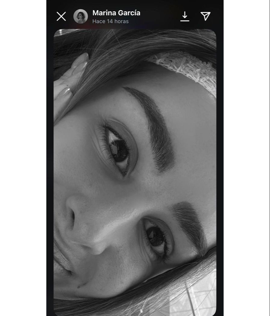 Marina García reaparece tras someterse a un trasplante capilar de cejas