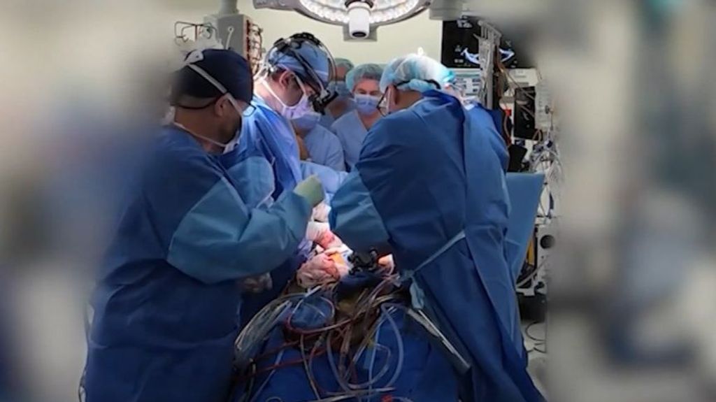 Vive durante 100 días con un corazón artificial de titanio hasta recibir un trasplante
