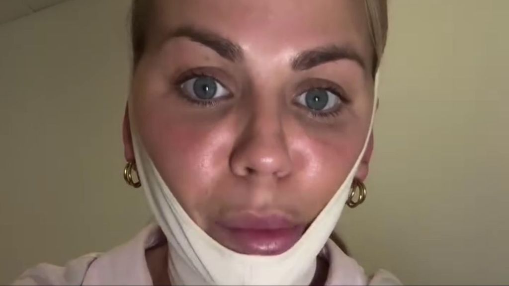 Yoli, de 'GH', reaparece con la cara vendada tras su paso por quirófano