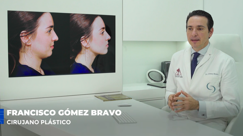 Especialistas en cirugía estética piden que se regule el uso de las fotografías del antes y el después de una intervención