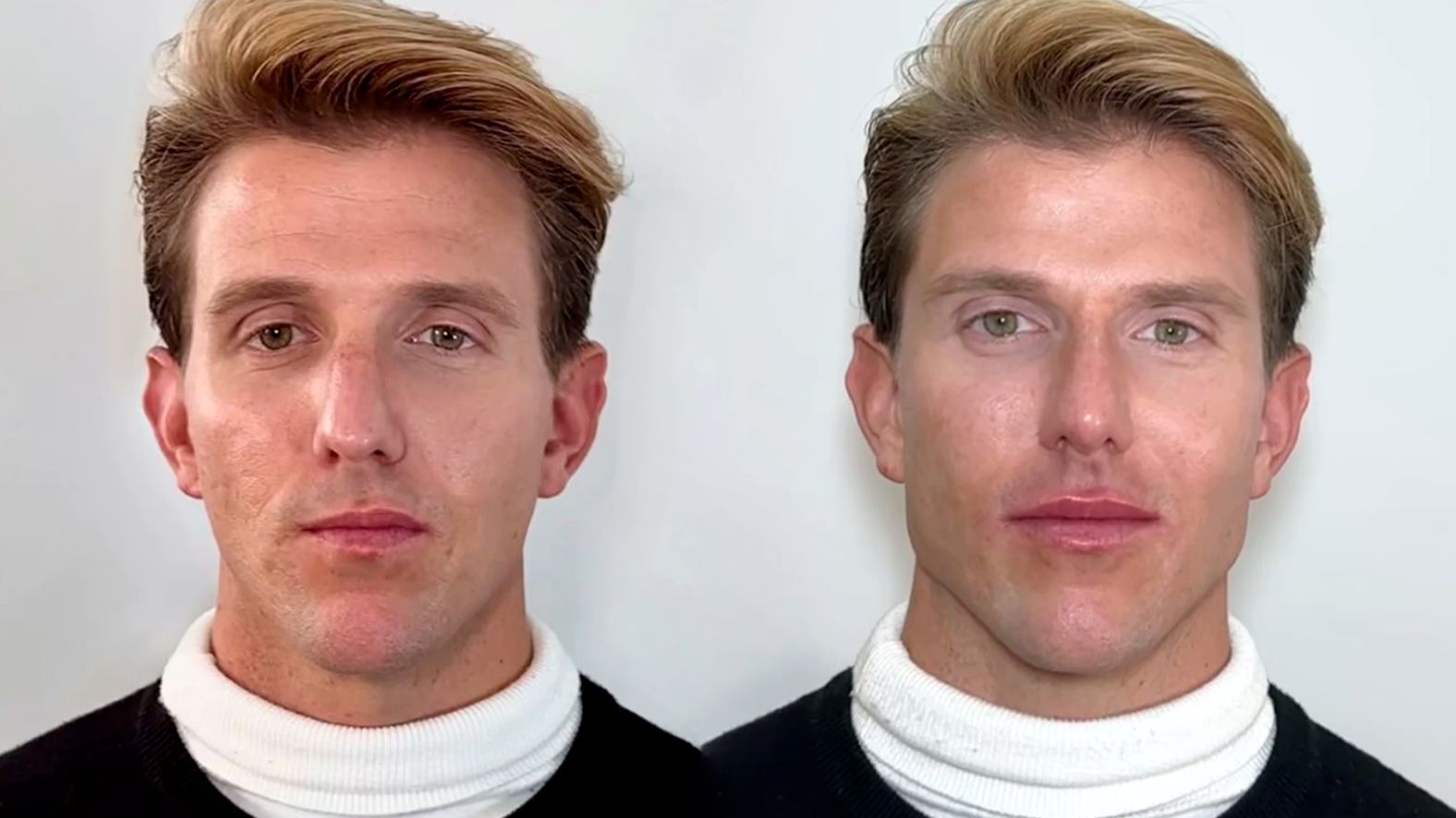 tadeo antes y después