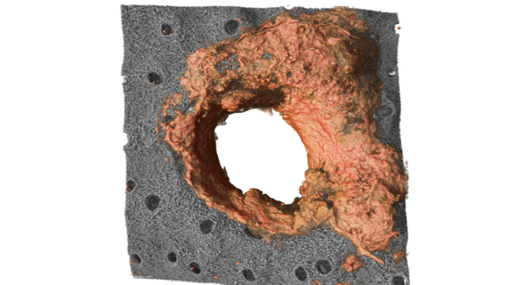 Reconstrucción 3D del anillo de colágeno (en naranja) producido por los neutrófilos que se forma alrededor de heridas en la piel.