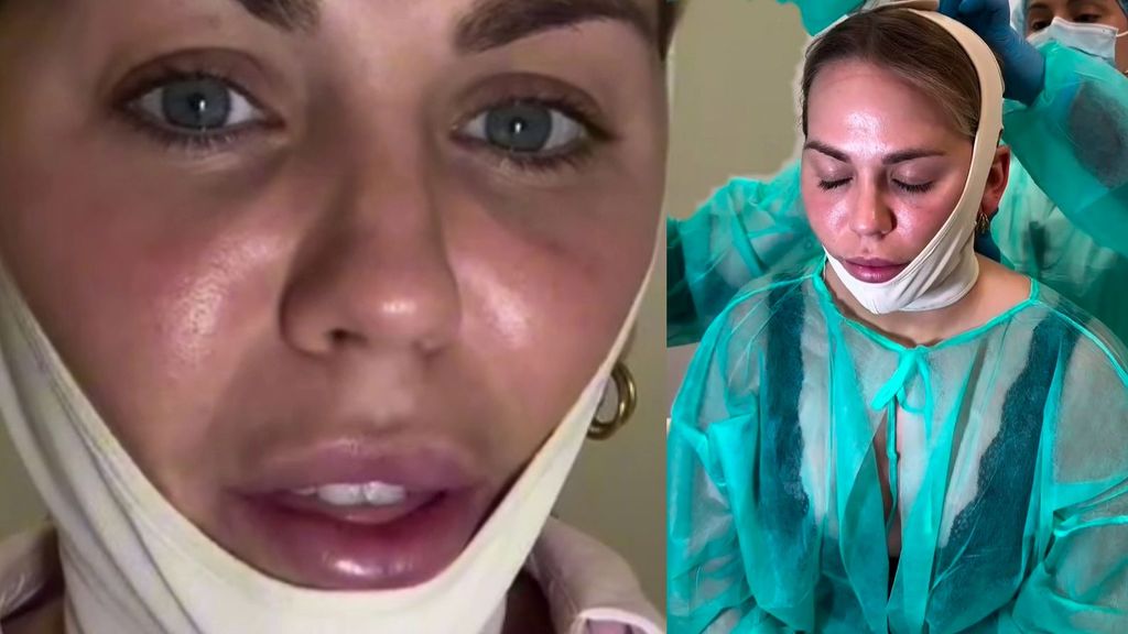 Yoli se quita las vendas y enseña su nueva cara tras su última operación estética